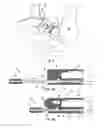 Fig. 03 - Anti-pinch system for vehicle seating