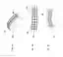 Fig. 04 - Invisible setting and methods and tools for effecting same