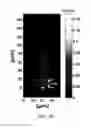 Fig. 07 - OPTICAL FIBER FOR GENERATING BESSEL BEAM AND OPTICAL IMAGING DEVICE USING SAME