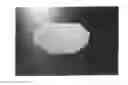 Fig. 01 - Artificial Perforated Tarsorrhaphy