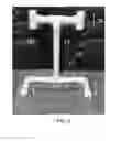 Fig. 02 - PELVIC ALIGNMENT ADJUSTMENT DEVICE