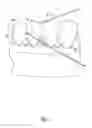 Fig. 05 - DENTAL FLOSS WITH ENHANCED FUNCTION