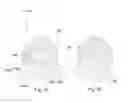 Fig. 12 - High impact resistant tool with an apex width between a first and second transitions
