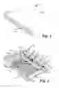 Fig. 02 - Medical device for preparing thermoplastic material