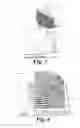 Fig. 04 - Medical device for preparing thermoplastic material