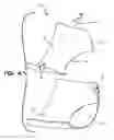 Fig. 07 - Tandem thrust reverser with multi-point actuation