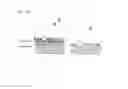 Fig. 03 - Device for generating heavy-ion beam and method thereof