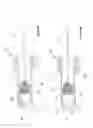 Fig. 06 - Advanced radio frequency sensing probe