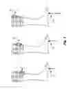 Fig. 08 - Sensory prosthetic for improved balance control