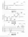 Fig. 09 - Interactive input system and method