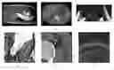 Fig. 01 - Method for processing image data representing a three-dimensional volume