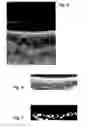 Fig. 04 - Method for processing image data representing a three-dimensional volume