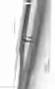 Fig. 32 - TUBULAR CAMERA MODULE