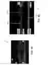 Fig. 06 - Automated assessment of glaucoma loss from optical coherence tomography