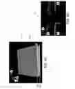 Fig. 07 - Automated assessment of glaucoma loss from optical coherence tomography