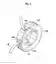 Fig. 09 - Lens device