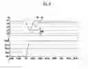 Fig. 07 - Voltage regulator and apparatus for controlling bias current