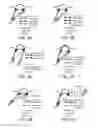 Fig. 06 - Binaural hearing assistance system comprising two wireless interfaces