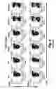 Fig. 06 - DUAL SPECIFIC BINDING PROTEINS DIRECTED AGAINST IMMUNE CELL RECEPTORS AND AUTOANTIGENS