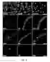 Fig. 07 - Multipotent Vascular Stem Cells and Methods of Use Thereof