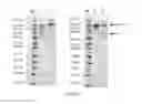 Fig. 03 - NOVEL PROCESS FOR PREPARATION OF ANTIBODY CONJUGATES AND NOVEL ANTIBODY CONJUGATES
