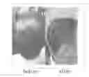 Fig. 01 - Composition for promoting hair growth