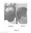 Fig. 04 - Composition for promoting hair growth
