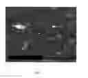Fig. 03 - Antibacterial sheet material that can be used as a wound dressing and method for producing same