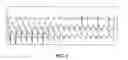 Fig. 03 - CUSTOM-FORMULATED PHOSPHOLIPID MICROBUBBLES AND METHODS AND USES THEREOF