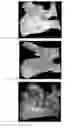 Fig. 05 - BONE FILLER MATERIAL AND METHODS OF USE