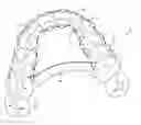 Fig. 01 - ORTHODONTIC DEVICE