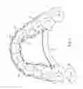 Fig. 02 - ORTHODONTIC DEVICE