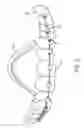 Fig. 03 - ORTHODONTIC DEVICE