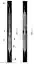 Fig. 02 - Dental instrument