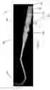 Fig. 06 - Dental instrument