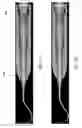Fig. 09 - Dental instrument