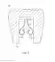 Fig. 06 - SPRING CLIP MOUNTED TO WITHDRAWABLE ARTIFICIAL TOOTH AND REMOVABLE ARTIFICIAL TOOTH ASSEMBLED WITH SAME
