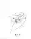 Fig. 33 - SPRING CLIP MOUNTED TO WITHDRAWABLE ARTIFICIAL TOOTH AND REMOVABLE ARTIFICIAL TOOTH ASSEMBLED WITH SAME