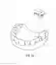 Fig. 35 - SPRING CLIP MOUNTED TO WITHDRAWABLE ARTIFICIAL TOOTH AND REMOVABLE ARTIFICIAL TOOTH ASSEMBLED WITH SAME