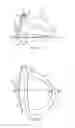 Fig. 02 - Golf club head with flexure