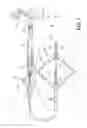 Fig. 02 - Method and determination of cardiac activation from electrograms with multiple deflections