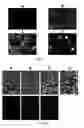 Fig. 06 - Wearable ultrasonic device for circulating tumor cell detection