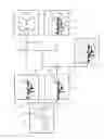Fig. 01 - Angiographic Examination Method for the Detection of Microembolizations