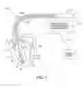 Fig. 02 - Methods and apparatus for detecting heart failure decompensation event and stratifying the risk of the same