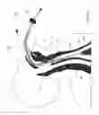 Fig. 17 - Devices and methods for airway measurement