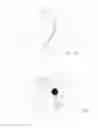 Fig. 03 - Incisionless Endoluminal Gastric Tissue Approximation for the Treatment Of Obesity