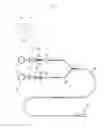 Fig. 02 - Operation device for performing procedure on lumen in body