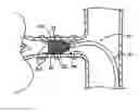 Fig. 01 - Catheter Apparatuses Having Expandable Mesh Structures for Renal Neuromodulation and Associated Systems and Methods