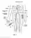 Fig. 03 - Catheter Apparatuses Having Expandable Mesh Structures for Renal Neuromodulation and Associated Systems and Methods