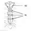 Fig. 01 - Sternal closure and ribs approximator devices